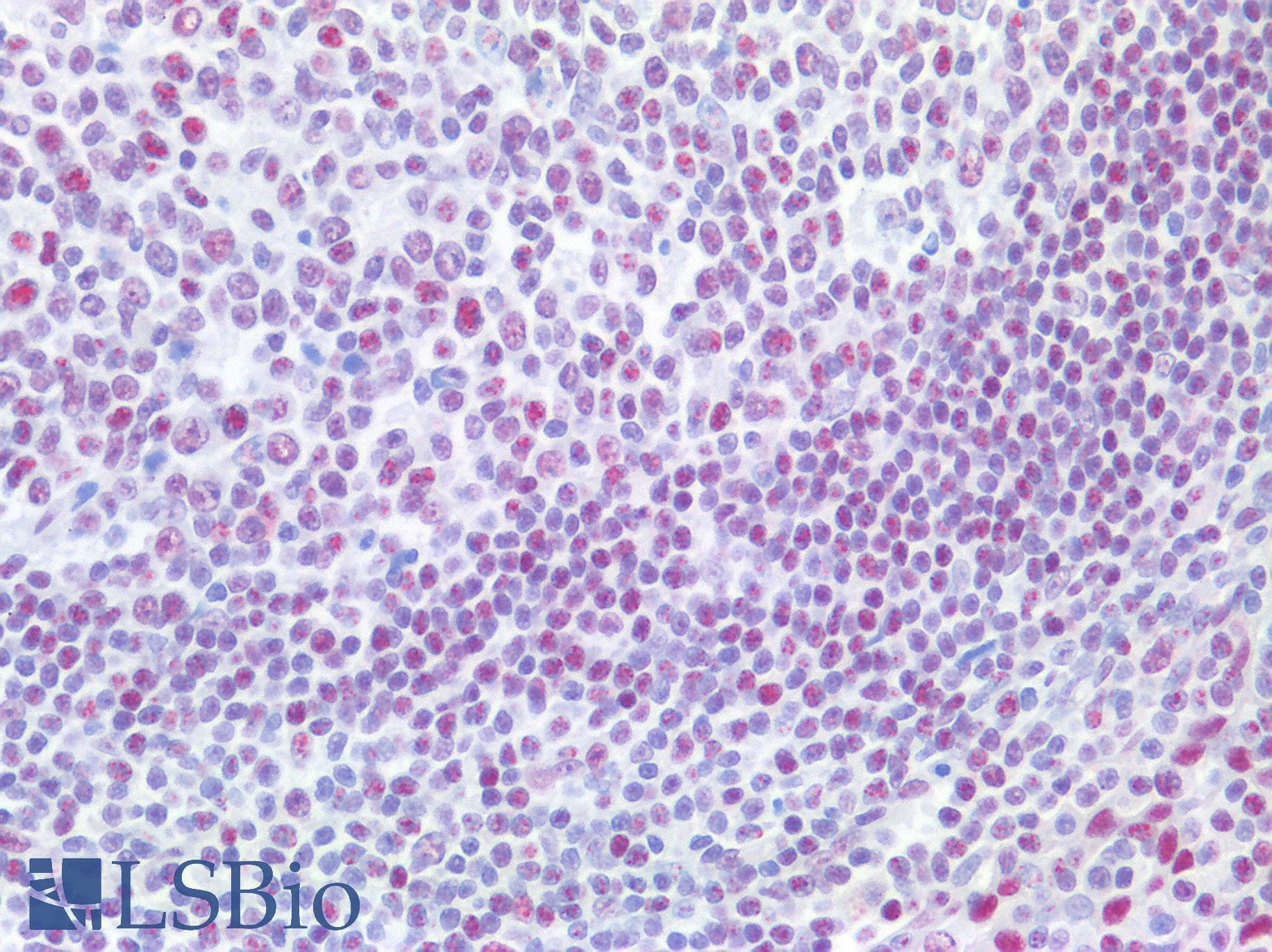 IHC-plus™ POLR2A / RNA polymerase II Antibody (1560-1640 aa)