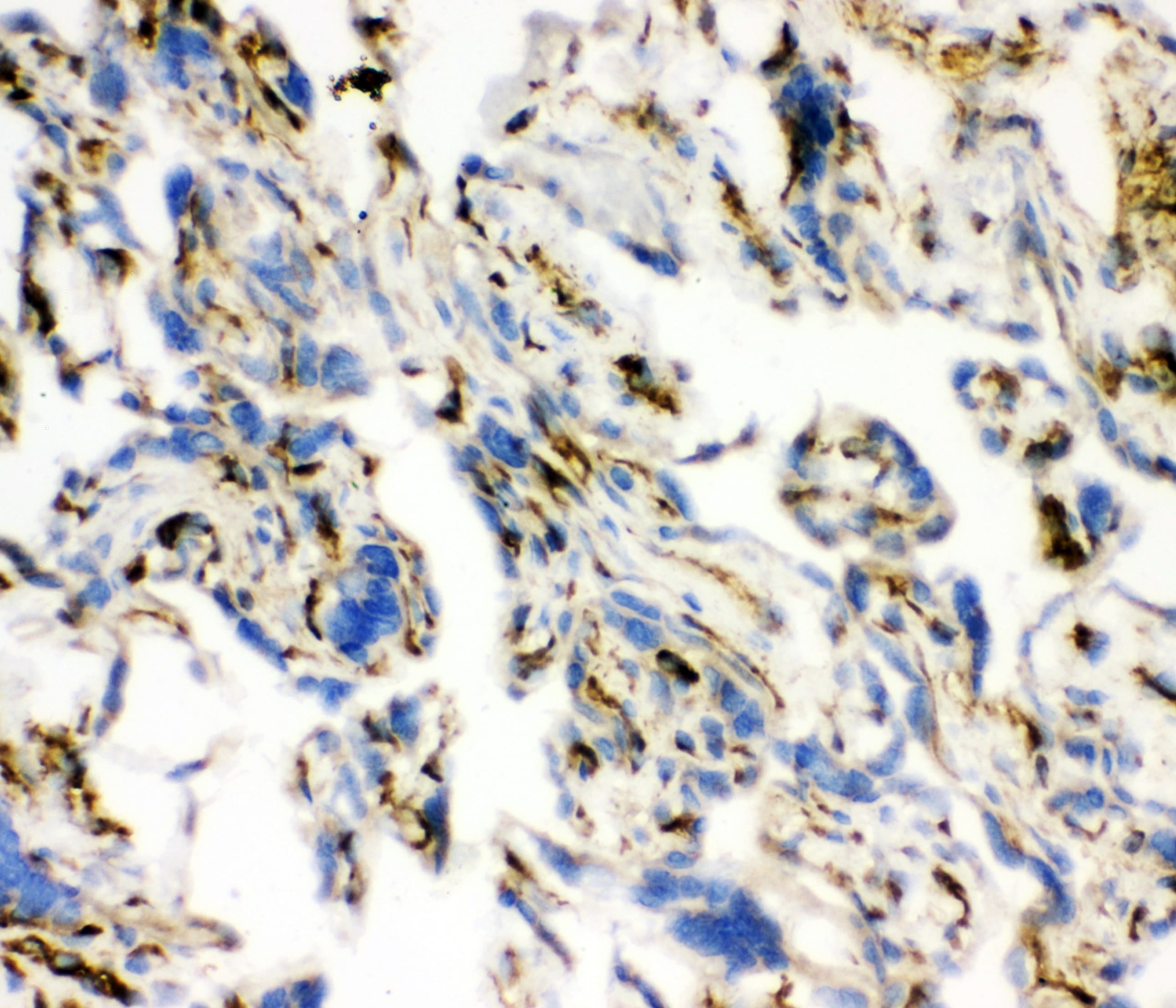 ACE / CD143 Antibody (aa651-864)