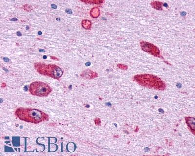 PathPlus™ GPR162 Antibody (Extracellular Domain)
