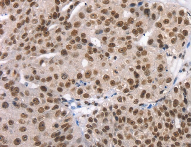 TAF15 Antibody