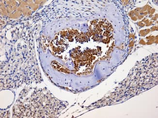 NBN / Nibrin Antibody (Internal)