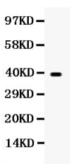 Polyclonal Rabbit anti-Human WNT7A Antibody (aa226-256, IHC, WB)