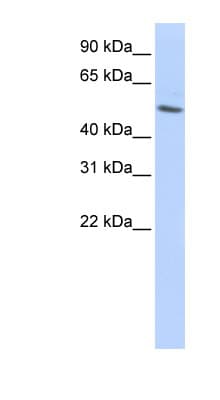 Polyclonal Rabbit anti-Human TUBB / Beta Tubulin Antibody (aa36-85, WB)