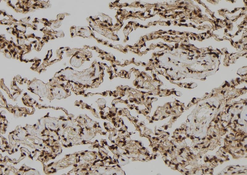 Polyclonal Rabbit anti-Human OTUB1 / OTU1 Antibody (IHC, IF, WB)