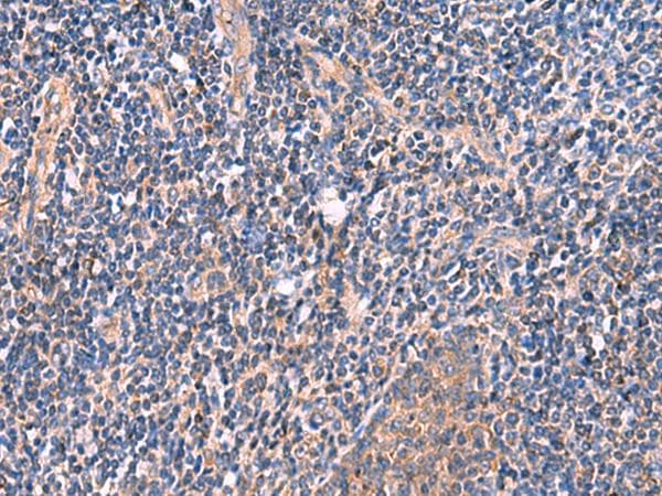 MYOT / Myotilin Antibody