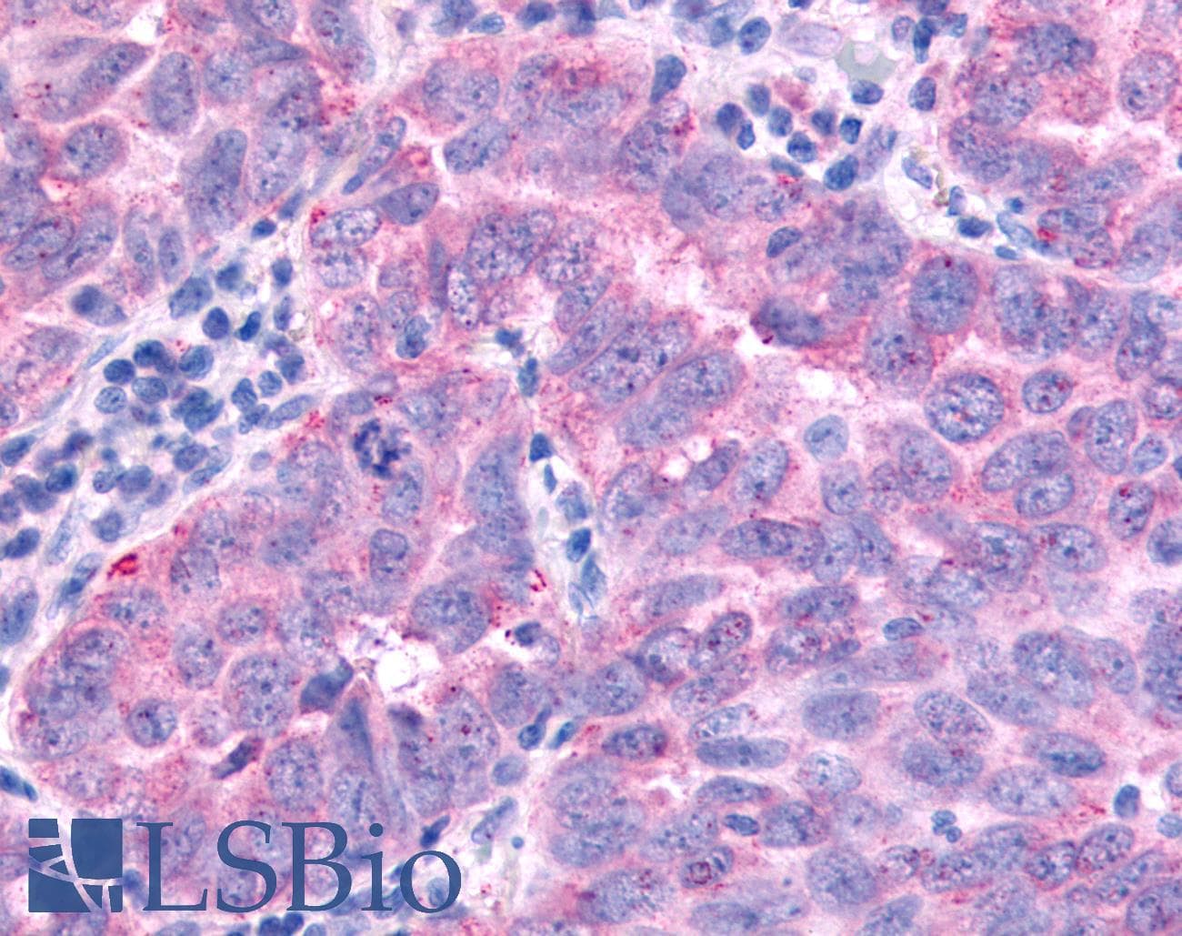 PathPlus™ PAK7/PAK5 Antibody (Internal)