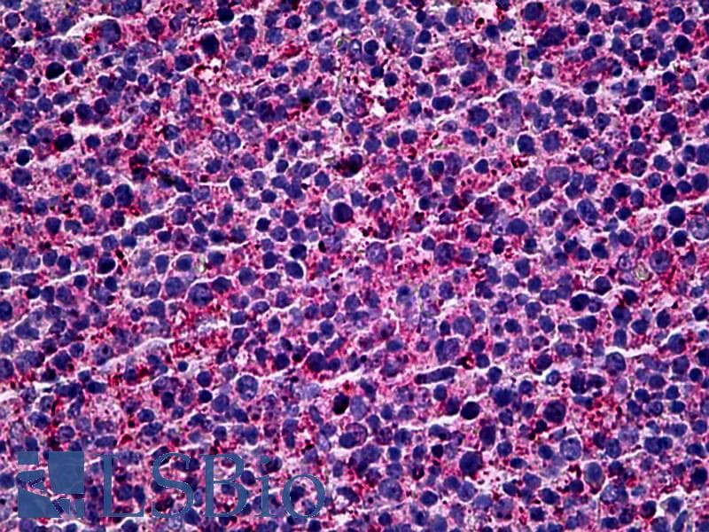 IHC-plus™ MKNK1 / MNK1 Antibody (clone 2H8)