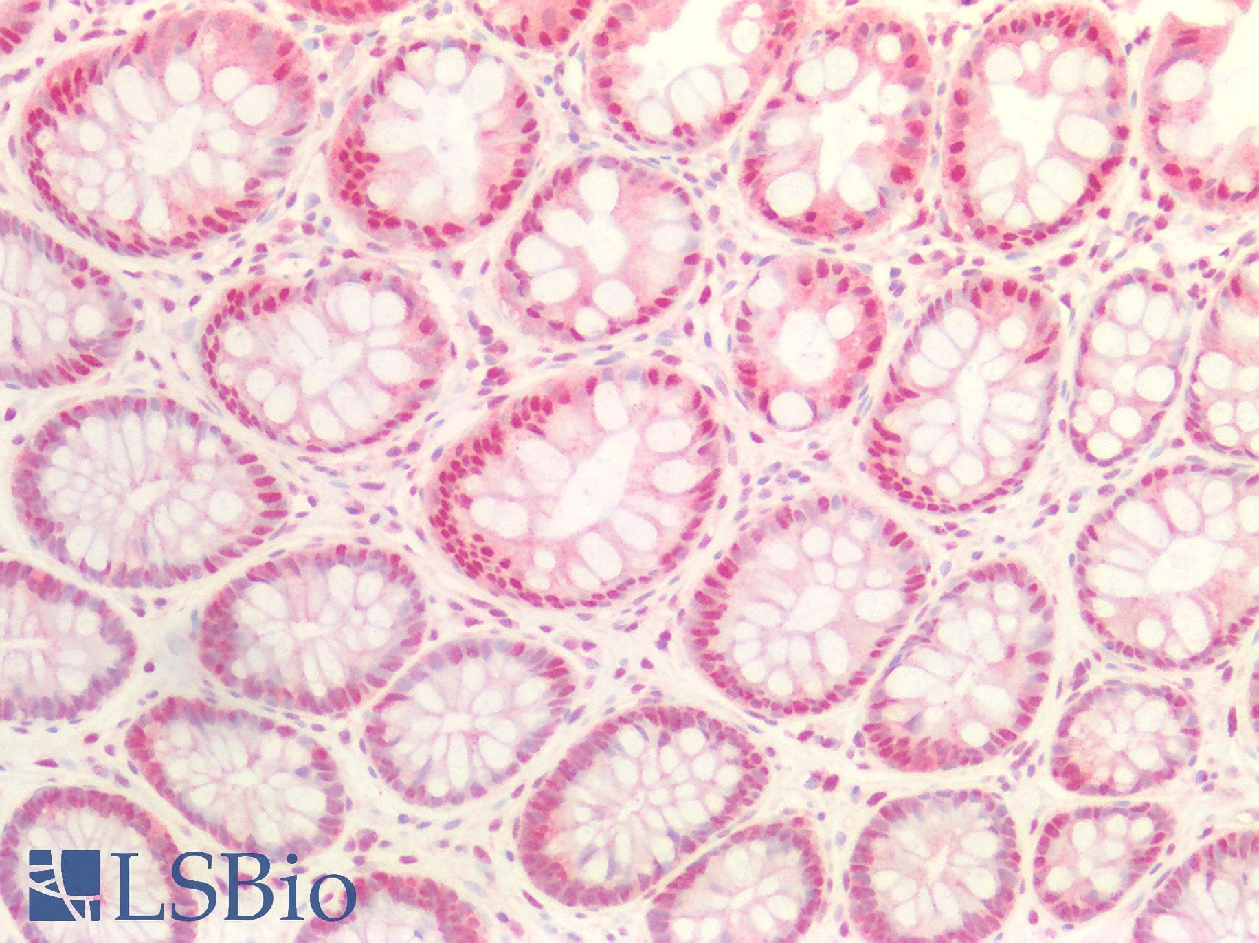 IHC-plus™ FEN1 Antibody (aa117-380, clone OTI1E1)