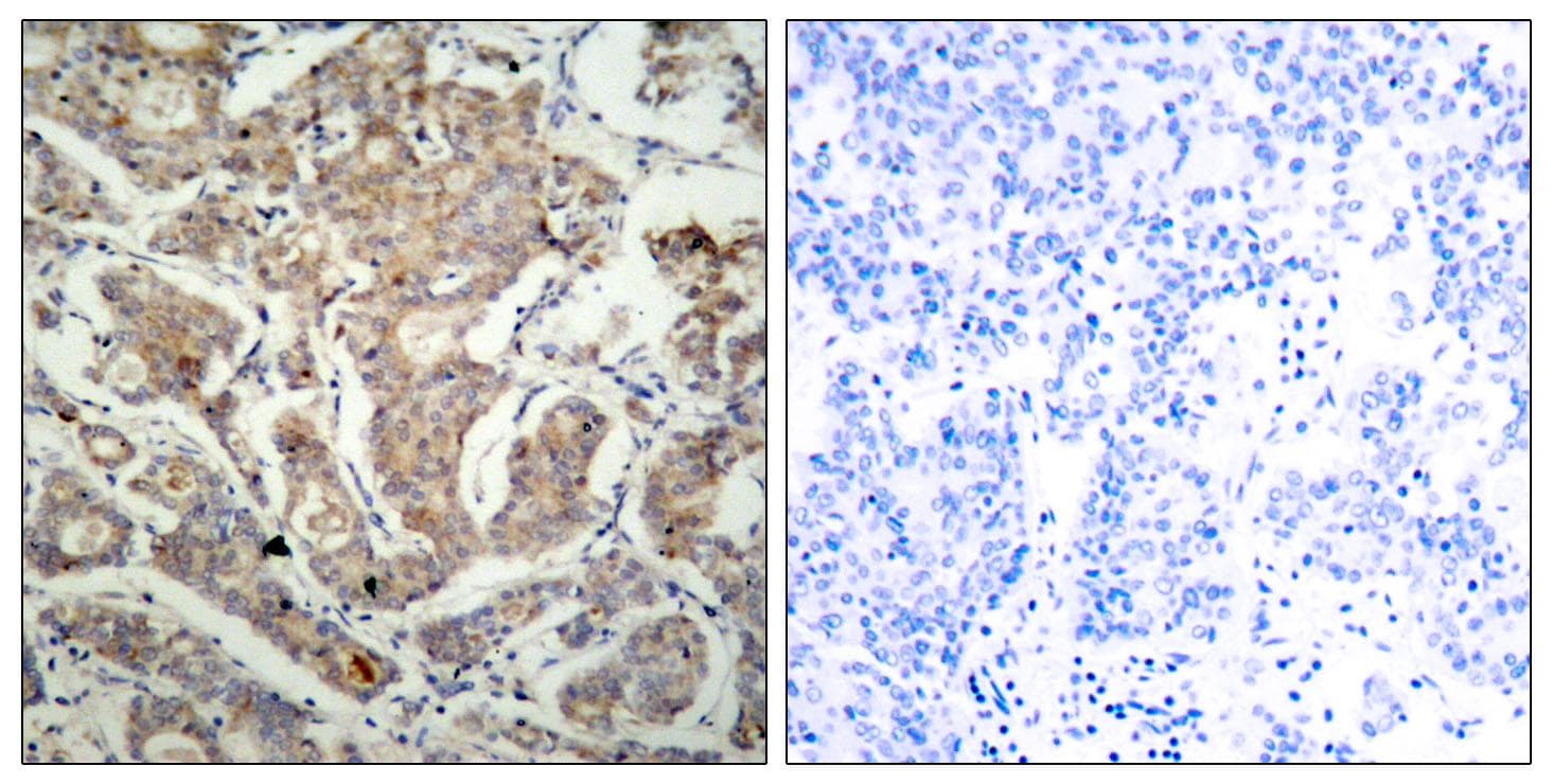 BAD Antibody (p155)
