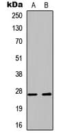 Polyclonal Rabbit anti-Human BPIFA1 / SPLUNC1 Antibody (Internal, WB)