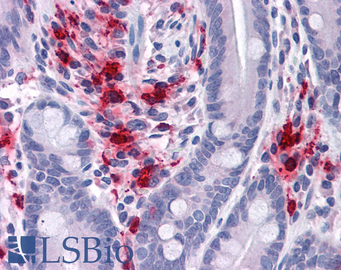 IHC-plus™ BMP15 Antibody