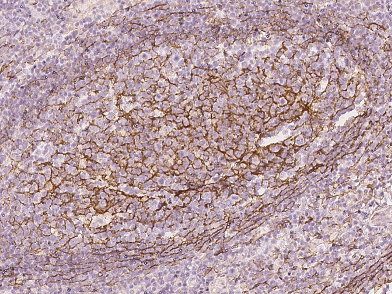 VCAM1 / CD106 Antibody (Preservative Free)