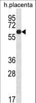GLCCI1 Antibody (aa226-255)