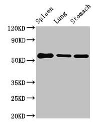 GLP1R / GLP-1 Receptor Antibody