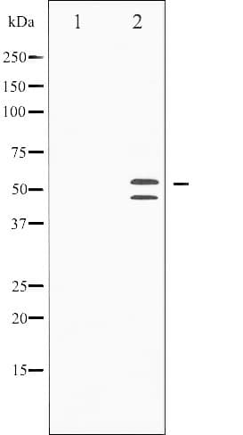 MAPK8 / JNK1 Antibody (phospho-Thr183)