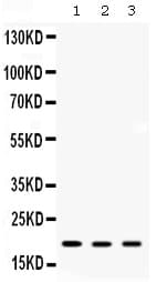 Polyclonal Rabbit anti-Human ARF6 Antibody (WB)