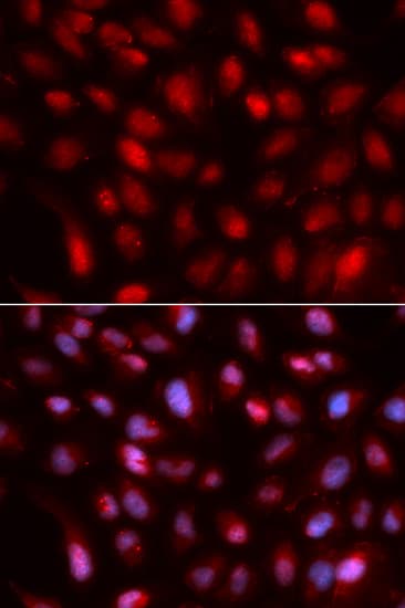 SUMO2 Antibody