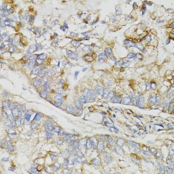 Polyclonal Rabbit anti-Human NDUFS7 Antibody (IHC, WB)