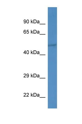 IPPK Antibody (aa366-415)