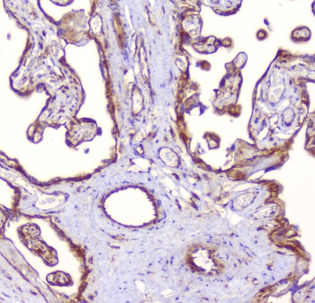 RP2 Antibody