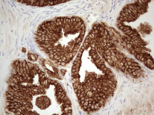 KRT18 / CK18 / Cytokeratin 18 Antibody (aa69-372, clone OTI2H10)