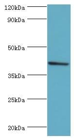 SULT2B1 / Sulfotransferase 2B1 Antibody (aa1-365)