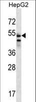 SLC29A3 / ENT3 Antibody (aa21-50)