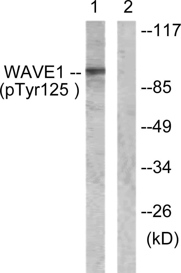 WASF1 / WAVE Antibody (phospho-Tyr125)