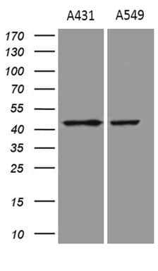 Monoclonal Mouse anti-Human ELF3 / ESE1 Antibody (clone OTI9H7, Carrier-free, aa175-286, WB)