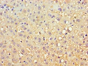 Polyclonal Rabbit anti-Human CBR3 Antibody (aa118-277, IHC, WB)