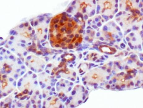 Polyclonal Rabbit anti-Human PDX1 Antibody (aa100-200, IHC, IF, WB)