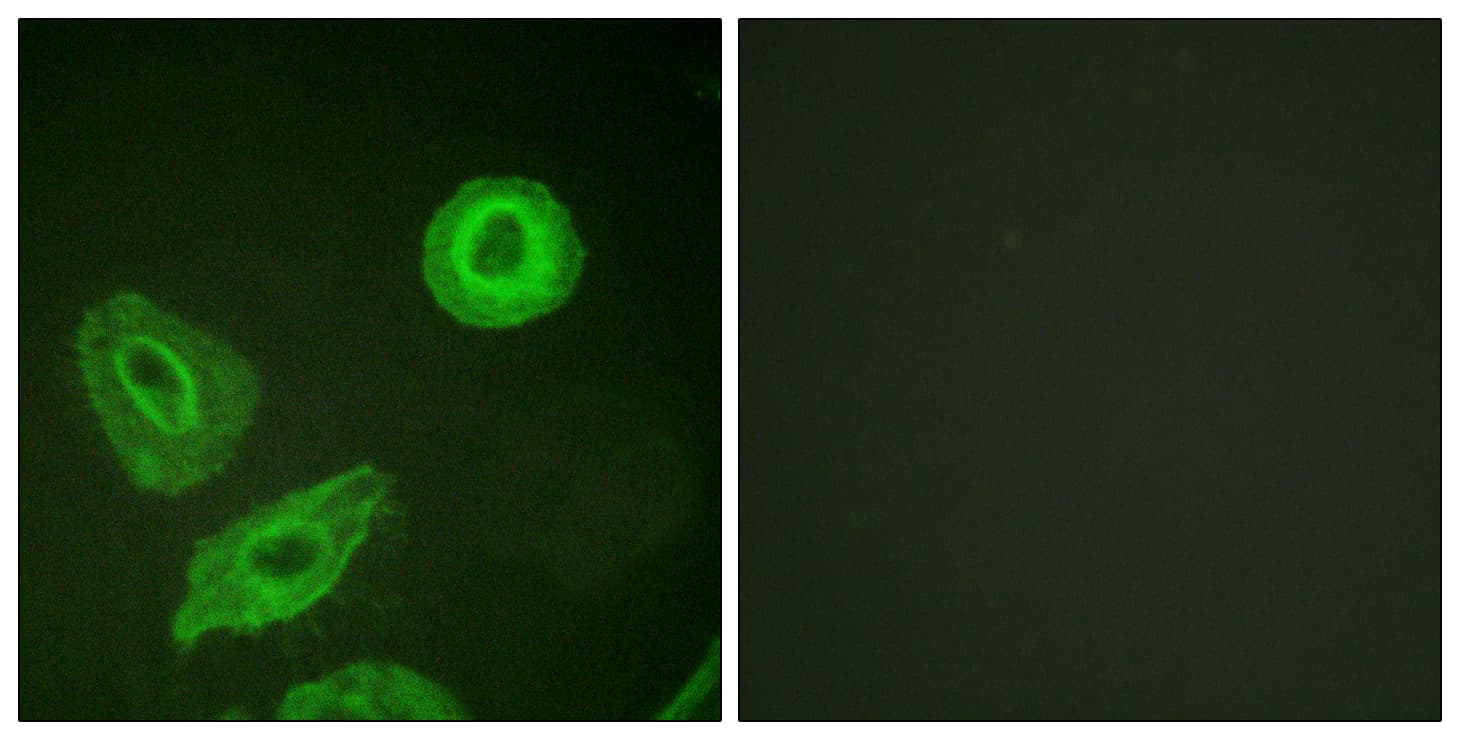 ERBB3 / HER3 Antibody (phospho-Tyr1289)