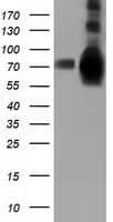 HSPA6 / HSP70B' Antibody (clone OTI1H3)