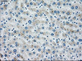 CHEK2 / CHK2 Antibody (clone OTI8D11)
