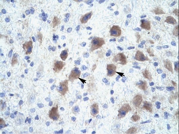 Polyclonal Rabbit anti-Human PAX9 Antibody (HRP, aa67-116, IHC, WB)