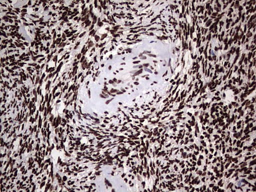 HNRNPL / hnRNP L Antibody (aa270-502, clone OTI2E4)
