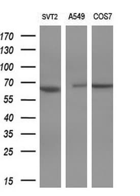 PAK4 Antibody (aa1-308, clone OTI1C7, Carrier-free)