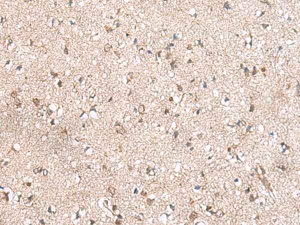 RPL23A Antibody