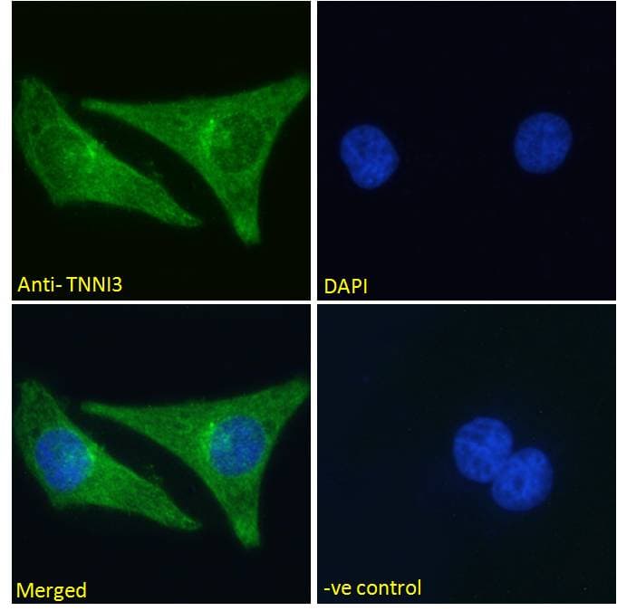 Polyclonal Goat anti-Human TNNI3 / Cardiac Troponin I Antibody (aa117-127, IF, WB)
