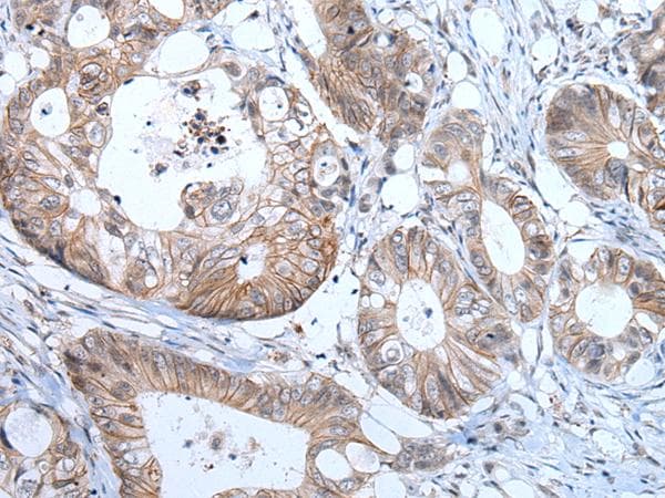 PRSS50 / TSP50 Antibody