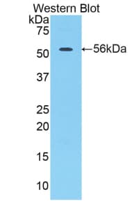CTSA / Cathepsin A Antibody (aa244-489)