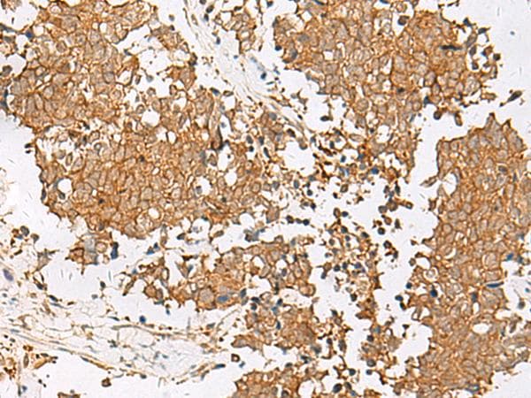 GSTM1 Antibody