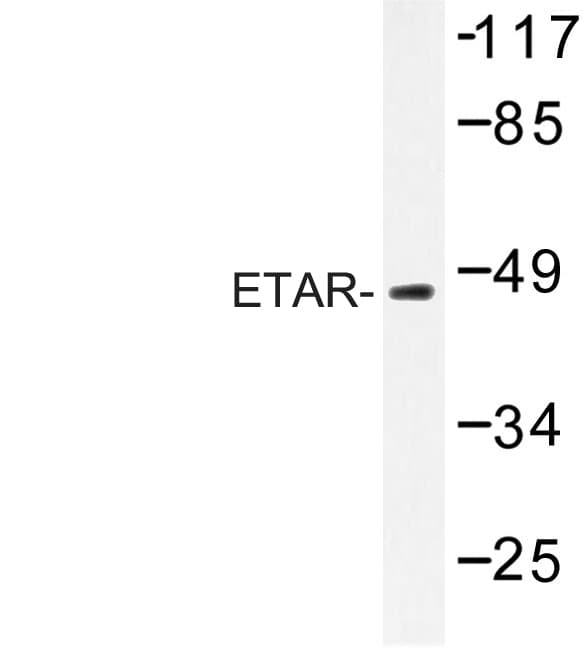 Polyclonal Rabbit anti-Human EDNRA / Endothelin A Receptor Antibody (Asp424, IHC, IF, WB)