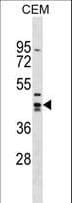 ZNF193 Antibody (aa217-243)