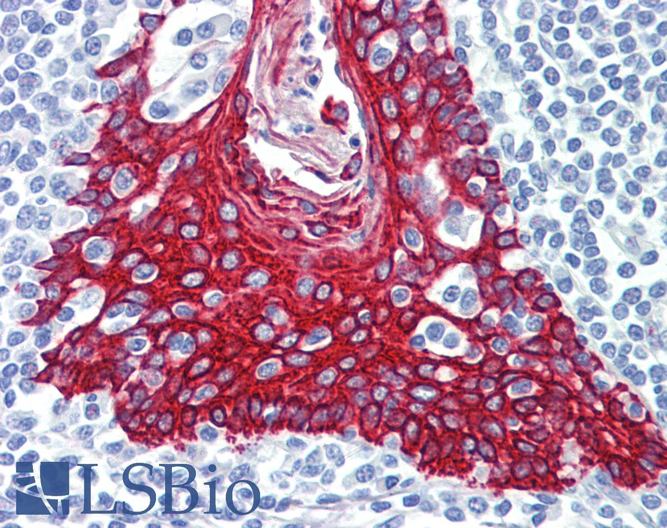 IHC-plus™ KRT5 / CK5 / Cytokeratin 5 Antibody (clone 10)