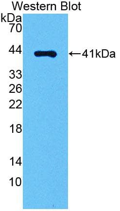 AGTR1 / AT1 Receptor Antibody (aa263-359)