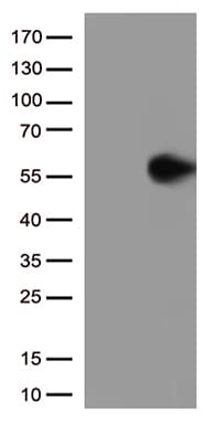 Monoclonal Mouse anti-Human GFAP Antibody (clone UMAB129, IHC, IF, WB)