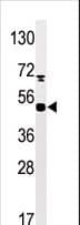 MAPKAPK5 / PRAK Antibody (phospho-Ser93)