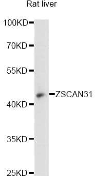 Polyclonal Rabbit anti-Human ZNF323 Antibody (WB)