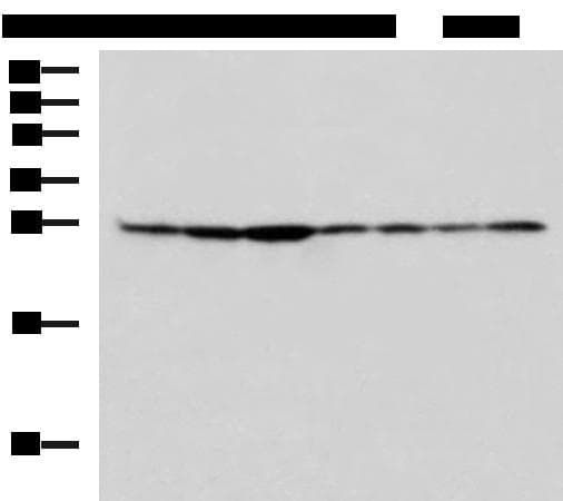 RPL10A Antibody